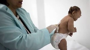 Nacen en Honduras de 8 bebés con microcefalia asociado al Zika