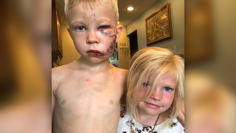 Se enfrentó a un perro para salvar a su hermana.