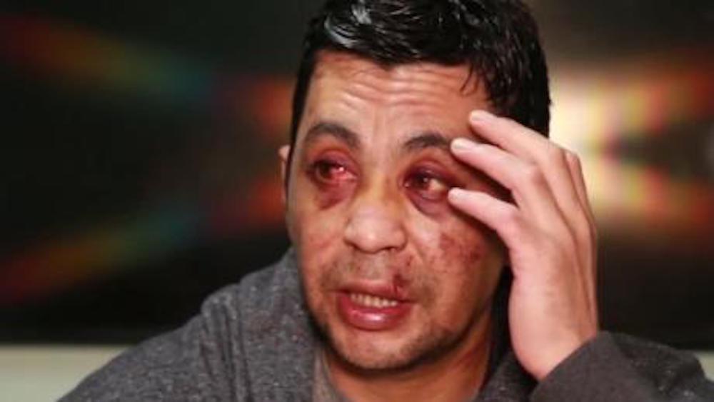 Argentina: Paciente de Covid-19 sufre brutal golpiza, queman su casa y le roban su carro.