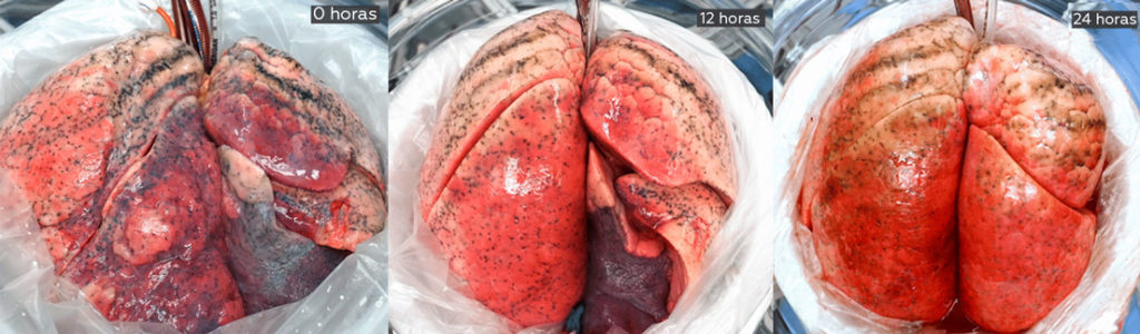 La contaminación atmosférica y su relación con el cáncer de pulmón