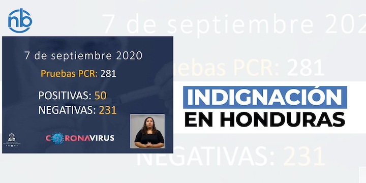 Gobierno solo realiza 280 test de Covid diarios