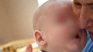 Madre abandona a bebé porque nació sin ojos, una familia lo adopta