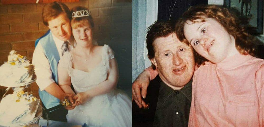 Pareja con síndrome de Down que rompió estereotipos.
