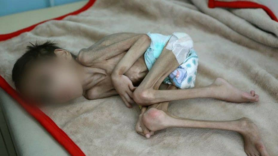 El drama en Yemen