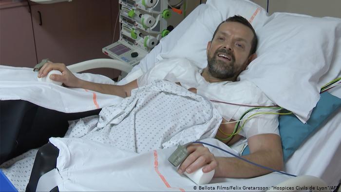 trasplante de brazos