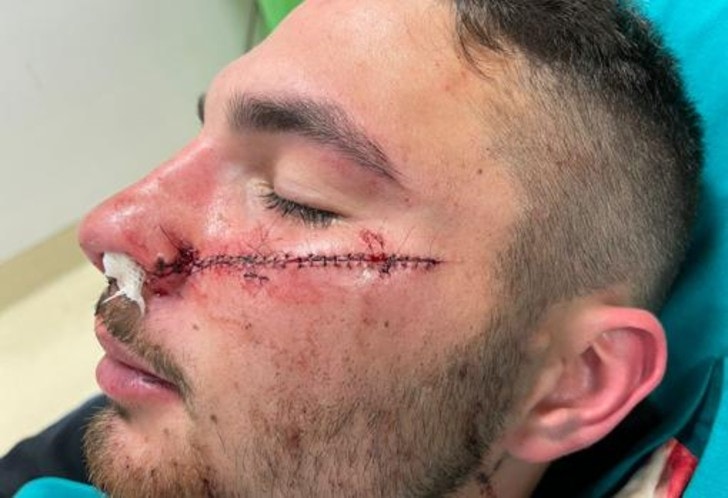 Valiente repartidor queda con una enorme cicatriz en su rostro tras defender a una menor: ‘Lo volvería hacer’
