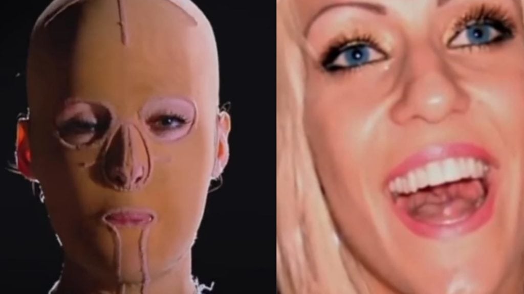 Dana, la sobreviviente de un terrible ataque de celos enfermizos que la dejó desfigurada de por vida