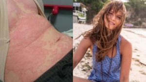 Mujer “alérgica” al trabajo, lo abandona y se cura viajando por el mundo
