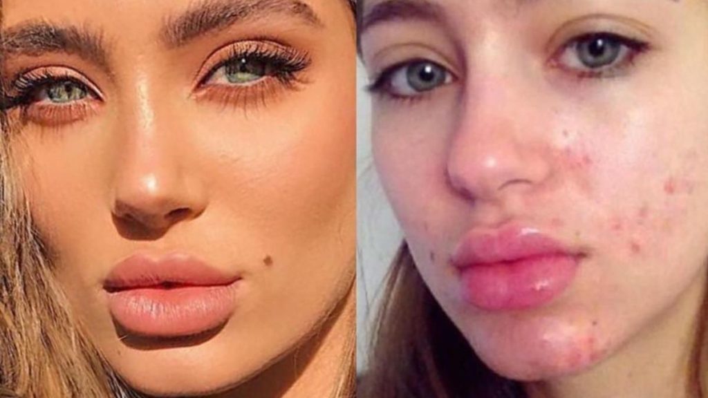 Obligarán a influencers a avisar si usan filtros en sus fotos por la salud mental de los seguidores