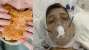 “Discapacitada de por vida” tras dislocarse la mandíbula comiendo una hamburguesa triple carne