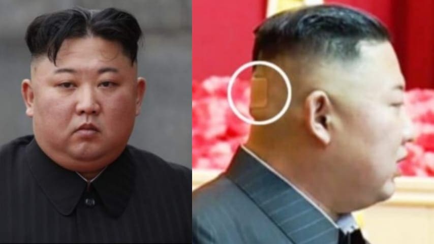 Kim Jong Un reaparece con extraño vendaje en la cabeza, surgen especulaciones su salud