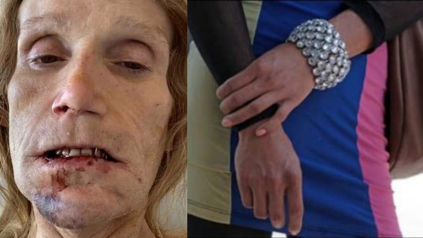 Mujer trans recibe golpiza en una cárcel de hombres