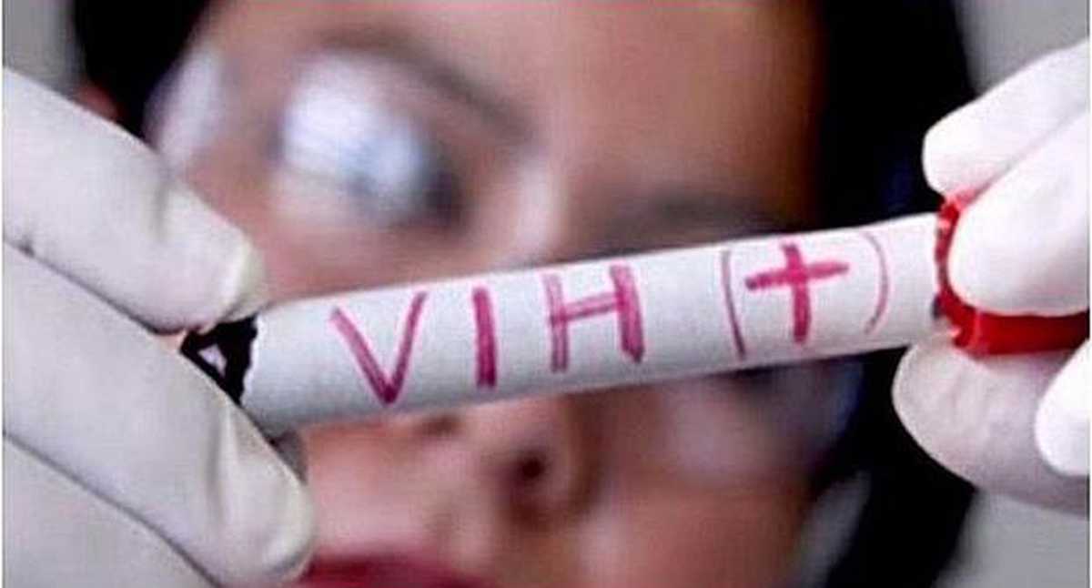 Detectan variante del VIH 4 veces más contagiosa y agresiva