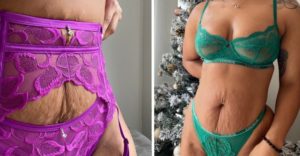 Marca de lencería revoluciona al usar mujeres “reales” con estrías como modelos