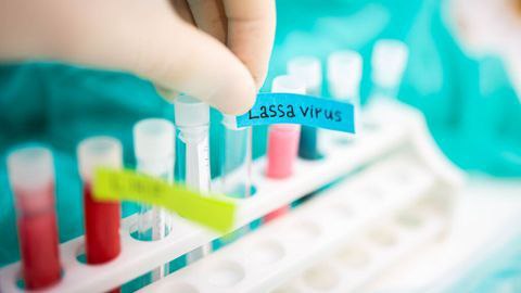Alerta en Reino Unido por dos casos similares al ébola