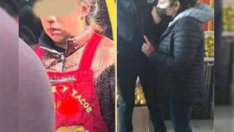 Mujer celosa le rompe la nariz a una niña porque estaba mirando a su esposo