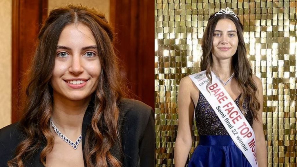 Miss Inglaterra busca alejarse de la belleza tóxica y compite sin una gota de maquillaje