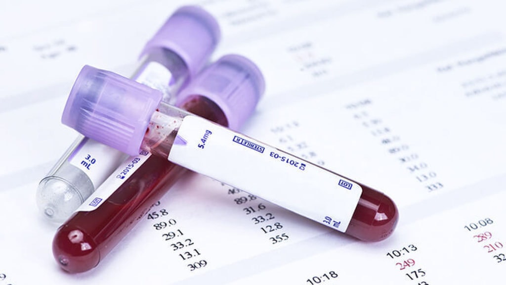 ¡Avances médicos! Más de 50 tipos de cáncer podrían detectarse con análisis de sangre