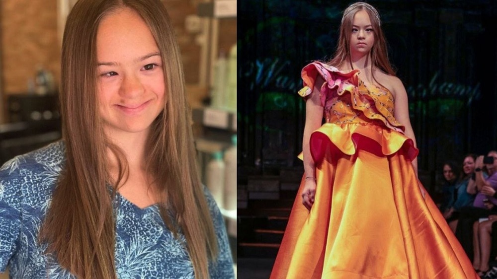 Modelo con síndrome brilla en la Semana de la Moda en NY “llevando la verdadera inclusión”