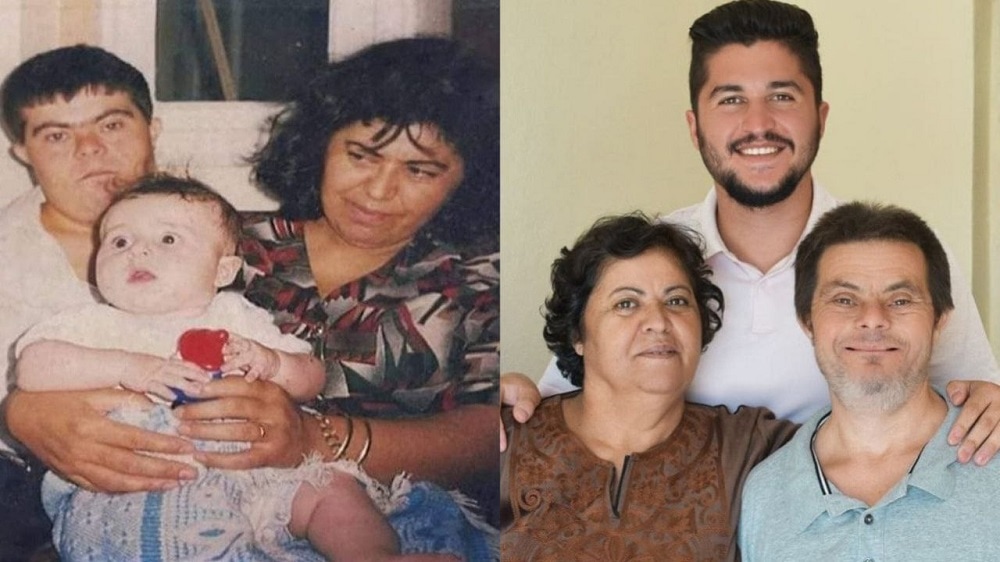 Padre con síndrome de Down crió a su hijo sin obstáculo y le dio sus estudios como médico