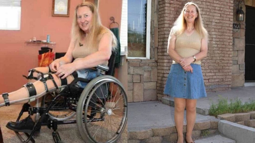 Mujer que se identifica como “transcapacitada” y finge tener un problema físico en los pies