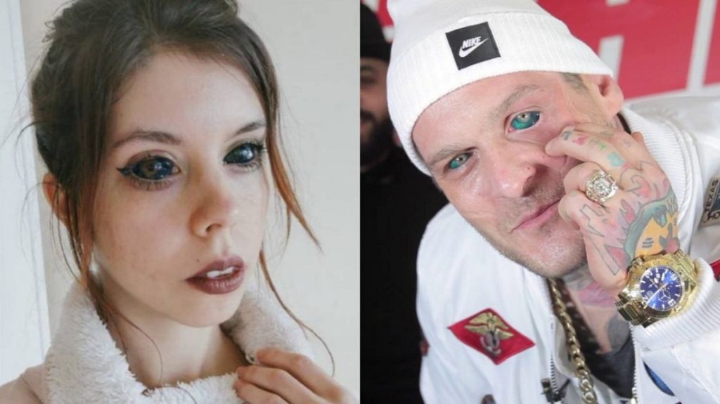 Joven modelo se tatuó los ojos para imitar a su artista favorito y quedó ciega