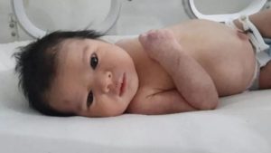 Miles de personas se ofrecen a adoptar al “pequeño milagro de Turquía”