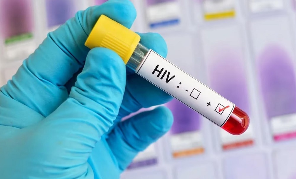 Un tercer paciente se cura de la infección por VIH tras un trasplante de células madre