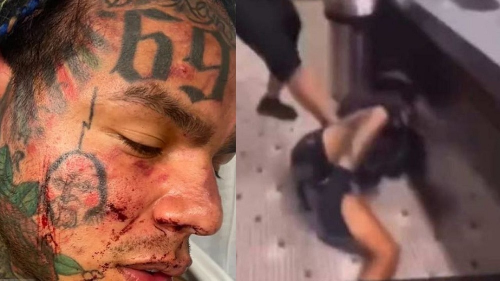 Rapero Tekashi 6ix9ine es hospitalizado por lesiones graves tras golpiza