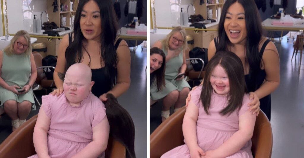 La expresión de felicidad de una niña con alopecia al recibir una peluca