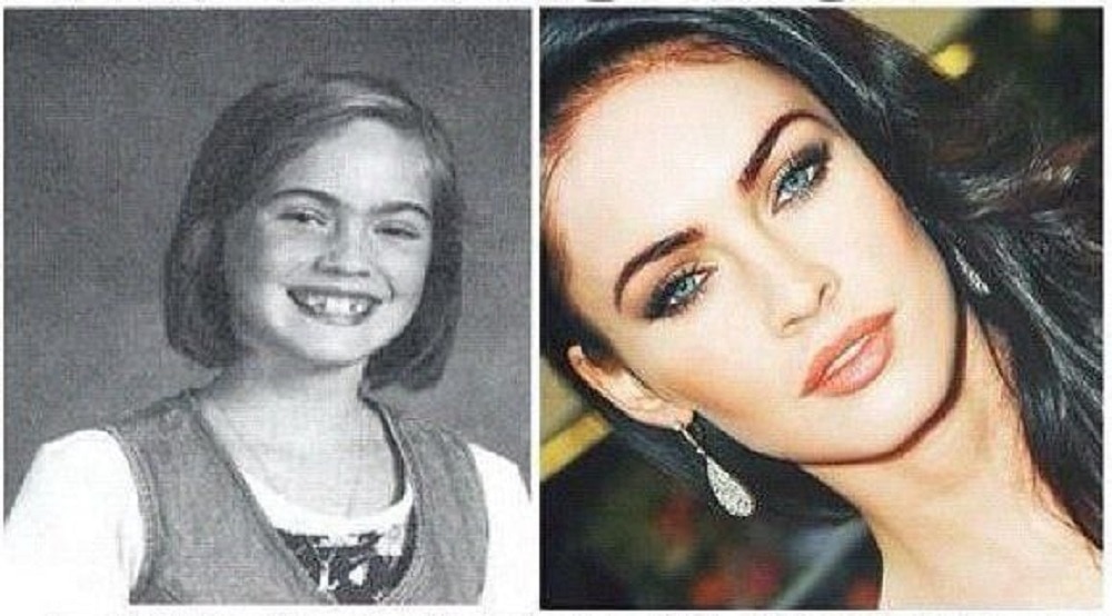 ¿Qué es la dismorfia corporal? El trastorno que sufre Megan Fox
