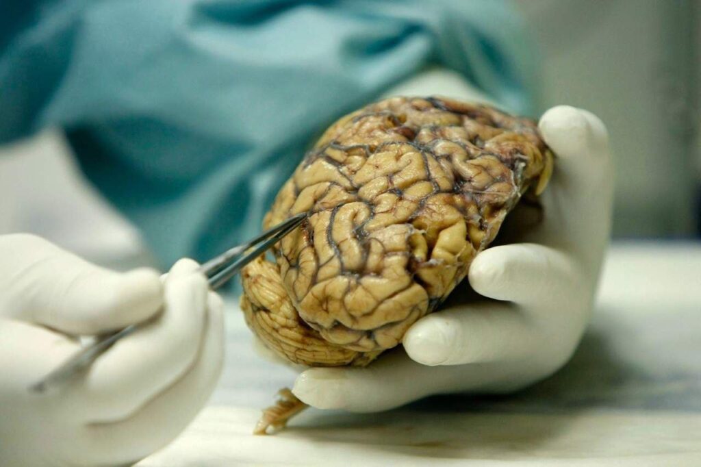 Descubren vínculo entre el cambio del clima y la disminución del tamaño del cerebro
