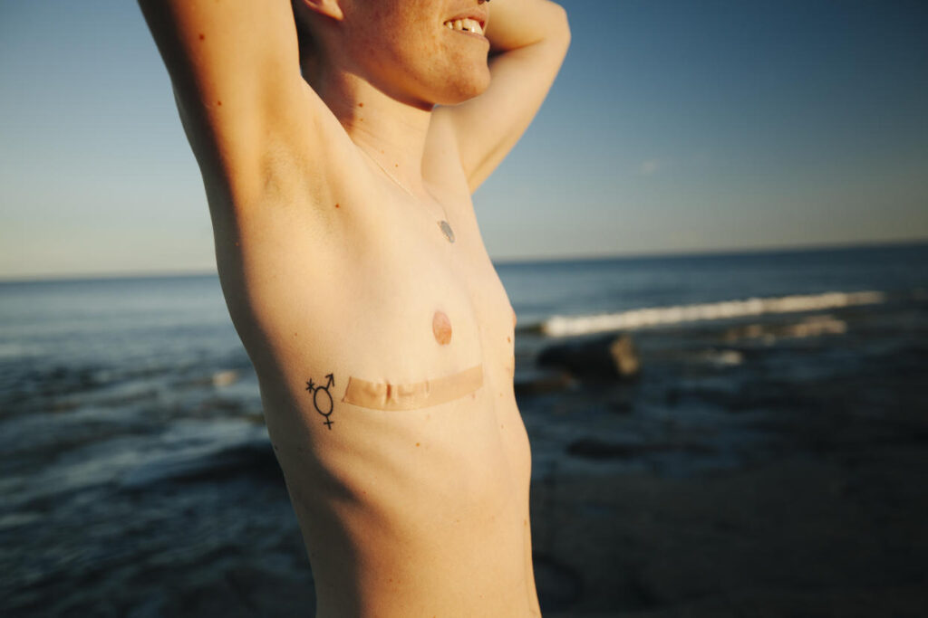 genero cambio de sexo