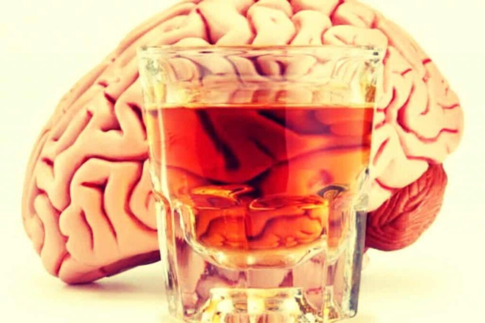 alcohol cerebro