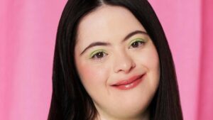 Ellie, la modelo con un diagnóstico desalentador que ahora representa a Vogue