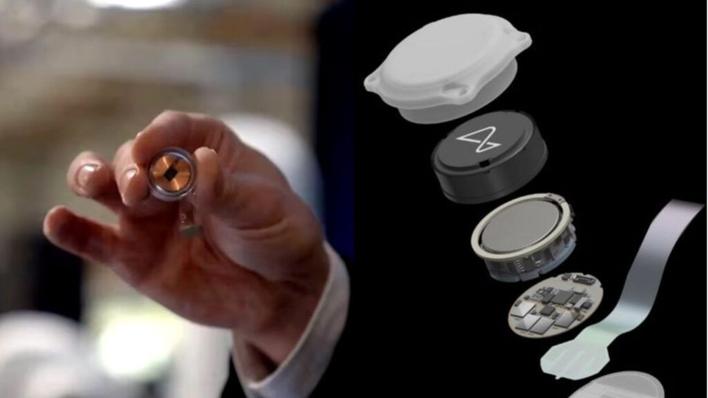 Por primera vez un humano recibe un implante cerebral