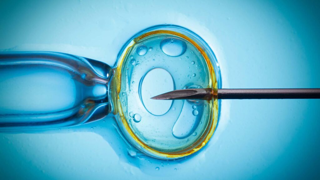 in-vitro-fertilization fertilización