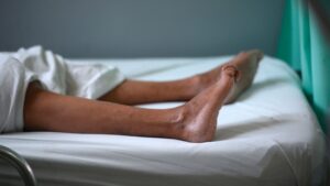 Casos de síndrome de Guillain-Barré preocupa a las autoridades sanitarias de México