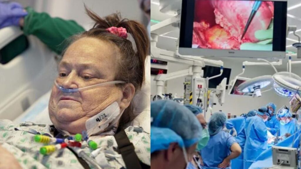 Mujer recibe el primer trasplante de bomba cardíaca y riñón de cerdo