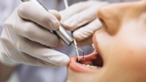 Primer ensayo en humanos para hacer crecer los dientes comienza en septiembre