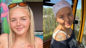 Maddy, la tiktoker con cáncer terminal que documentó todo su tratamiento antes de morir