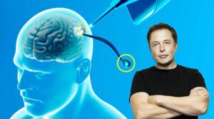 Neuralink de Elon Musk está en busca de un segundo candidato para probar su chip cerebral