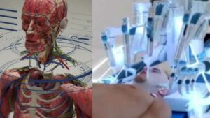 Trasplante de cabeza de un cuerpo a otro será una realidad, según BrainBridge