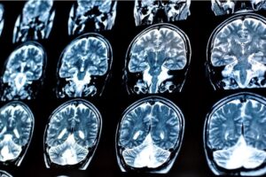 Crean un “ordenador vivo” al conectar 16 minicerebros humanos