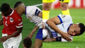 Mbappé quedaría afuera del próximo partido de la Eurocopa por su fractura en la nariz