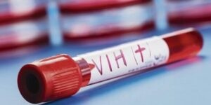 Vacuna contra el VIH supuestamente con 100% de efectividad es suministrada a 42,000 dólares al año