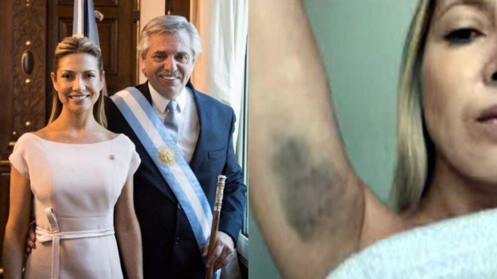 Escándalo en Argentina: Expresidente Alberto Fernández es denunciado por violencia doméstica