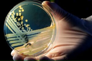 Superbacterias podrían causar la muerte de 39 millones de personas