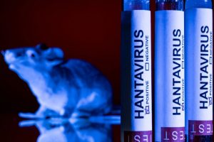 Cepa de hantavirus podría permanecer años en el cuerpo