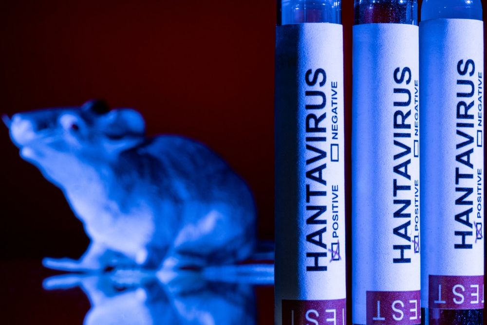 hantavirus,